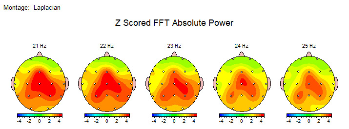 EEG results showing chronic pain